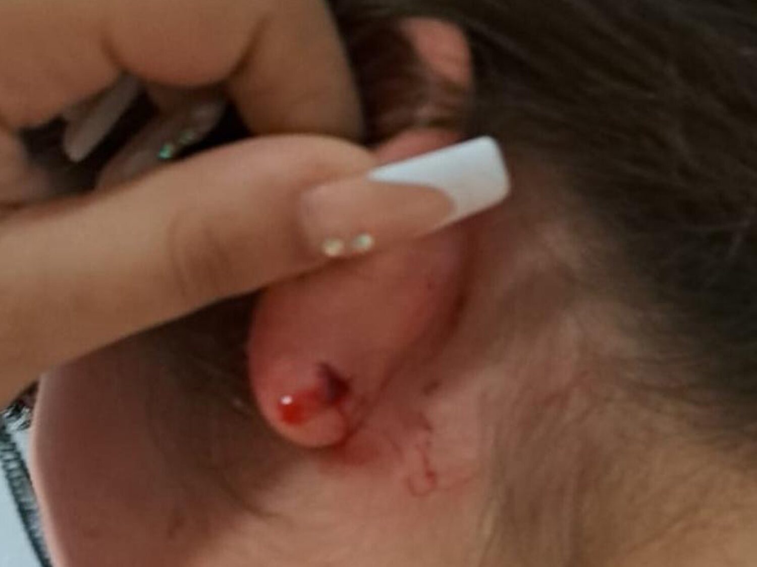 Brutal paliza a una niña trans de 13 años en Granada: "Travelo, te voy a matar"