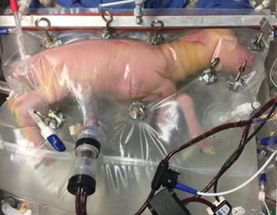 Crean un útero artificial para salvar la vida de los bebés prematuros