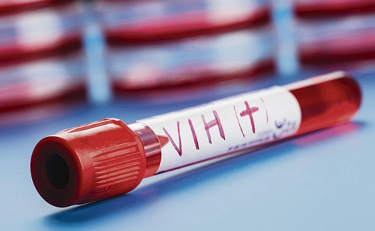 El VIH, una enfermedad muy estigmatizada