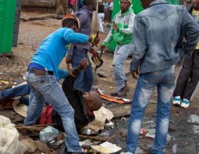 Asesinan a cinco calvos en Mozambique para usar sus órganos en rituales mágicos