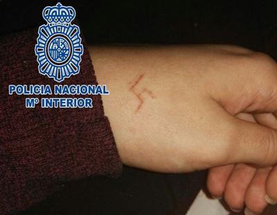 Detenidos seis ultras por marcar la esvástica con un objeto ardiente en la mano de una menor