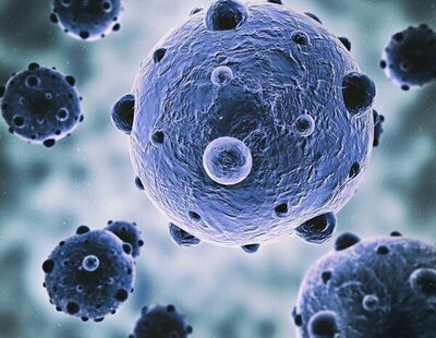 Hallan un marcador que pronostica respuestas a la quimioterapia en pacientes de cáncer