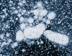 Hallan un gen expandiéndose en todo el mundo que transforma a las bacterias en incurables