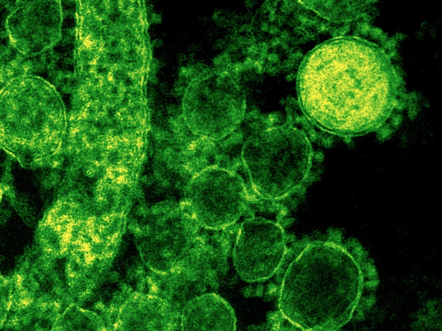 Más del 70% de los genes con resistencia a antibióticos están en la cadena alimentaria