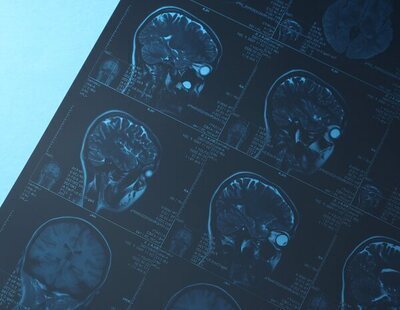 Lleva a su hijo al hospital y se fractura el cráneo en plena radiografía en Pontevedra