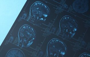 Lleva a su hijo al hospital y se fractura el cráneo en plena radiografía en Pontevedra