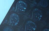 Lleva a su hijo al hospital y se fractura el cráneo en plena radiografía en Pontevedra