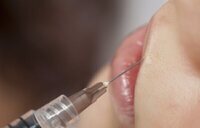 Detenida en Málaga una influencer por inyectar ácido hialurónico ilegalmente