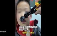 Rescate insólito en China: cortan un candado atrapado en la nariz de un niño