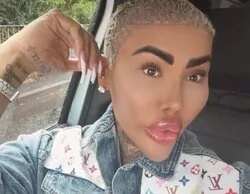 Muere el influencer Jordan James: gastó 150.000 euros en cirugías para ser Kim Kardashian