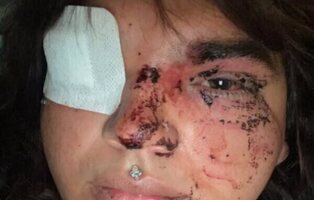 Agresión en grupo a una mujer transexual en León