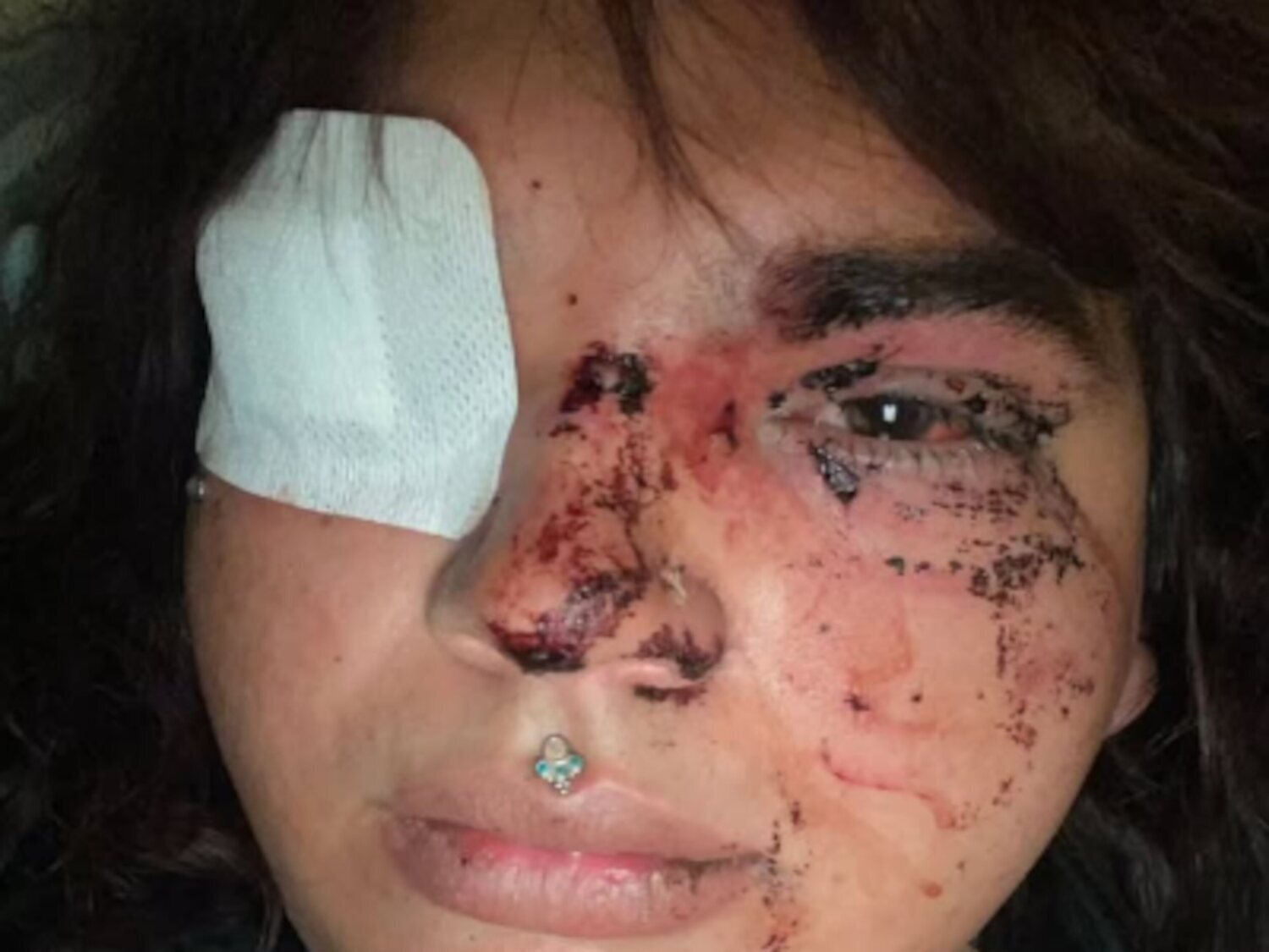 Agresión en grupo a una mujer transexual en León