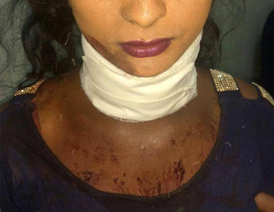 Le cortan la garganta a una mujer trans en India y tres hospitales se niega a atenderla