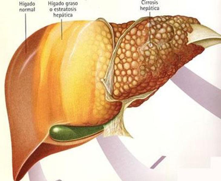 El hígado comenzará a trabajar más de la cuenta