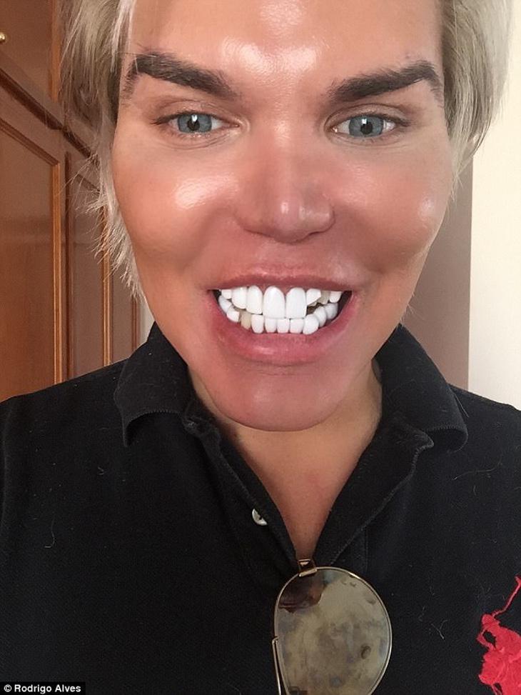 Rodrigo Alves publicó en su instagram el catastrófico resultado de su noche de excesos