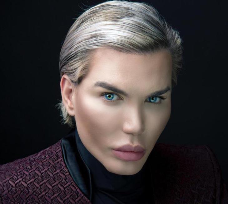 Rodrigo Alves ha pasado por quirófano más de 60 veces y ha recibido unos 100 tratamientos corporales