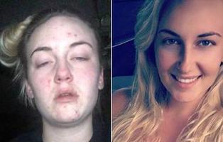 Antes y después: así han cambiado algunas mujeres que decidieron abandonar las drogas