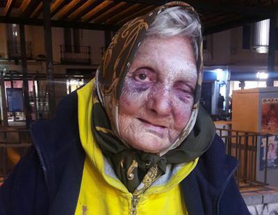 Cuatro jóvenes fascistas agreden a una anciana sin hogar de 84 años en Madrid