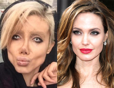 50 operaciones para ser como Angelina Jolie y termina pareciéndose a la novia cadáver