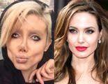 50 operaciones para ser como Angelina Jolie y termina pareciéndose a la novia cadáver