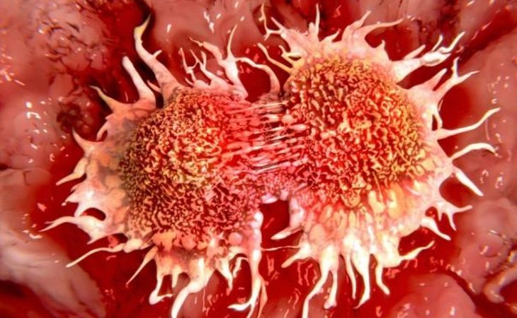 Los casos de cáncer están aumentando las muertes de la población