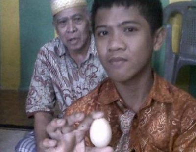 Un niño en Indonesia asegura que pone huevos: expulsó dos en el hospital