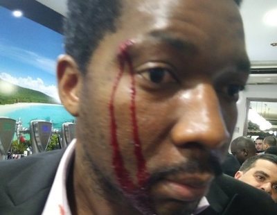 La Policía no ve delito de odio en la agresión a un actor negro sino un "altercado de bar"