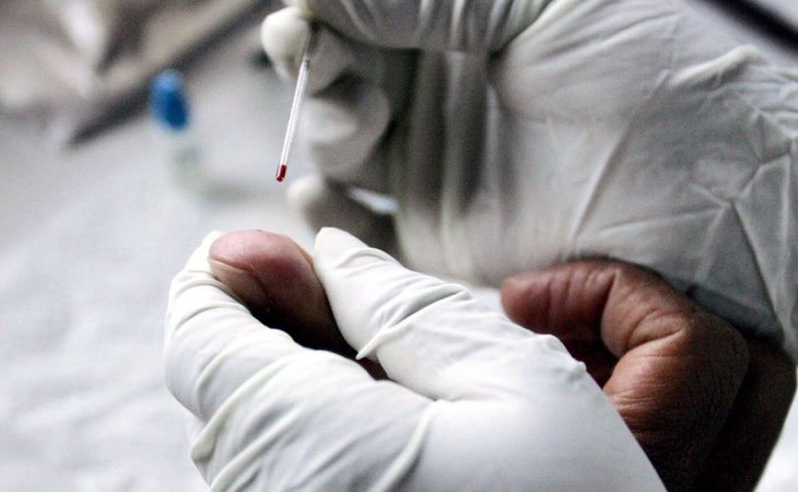 La prueba de sangre ha sido publicada en EMBO Molecular Medicine