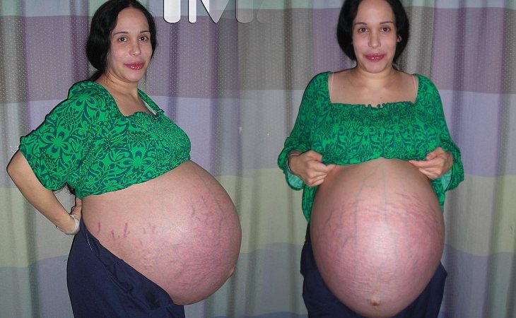Natalie Suleman durante su embarazo
