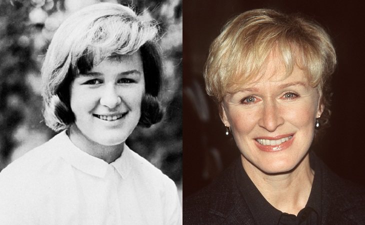 Glenn Close en 1968, siendo miembro de Moral Re-Armament, y en la actualidad