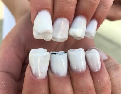 Las 'uñas dentadura': la nueva tendencia que está causando furor