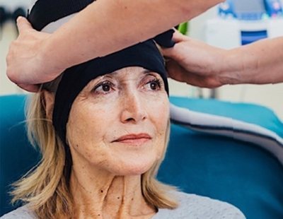 Un casco evita la caída del cabello durante la quimioterapia en los pacientes con cáncer