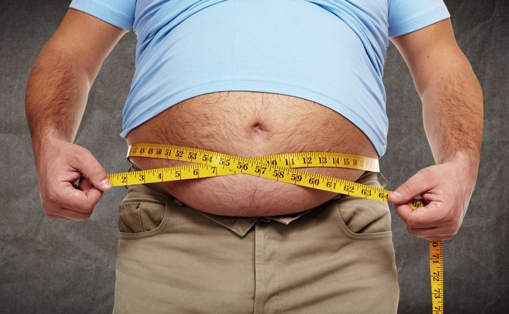 La obesidad es una enfermedad que entraña múltiples riesgos