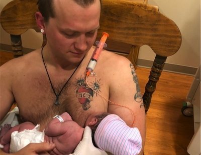 Este padre "amamanta" a su bebé con un pezón falso