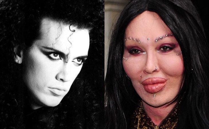 El antes y después de Pete Burns