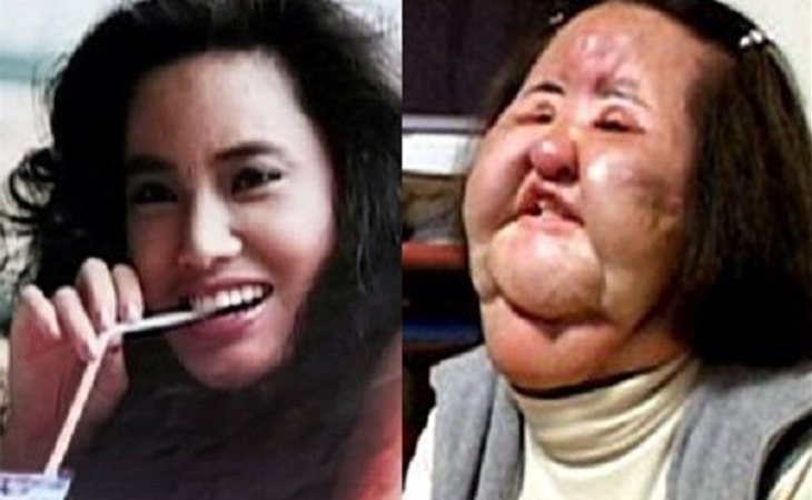 El antes y después de la exmodelo Hang Mioku