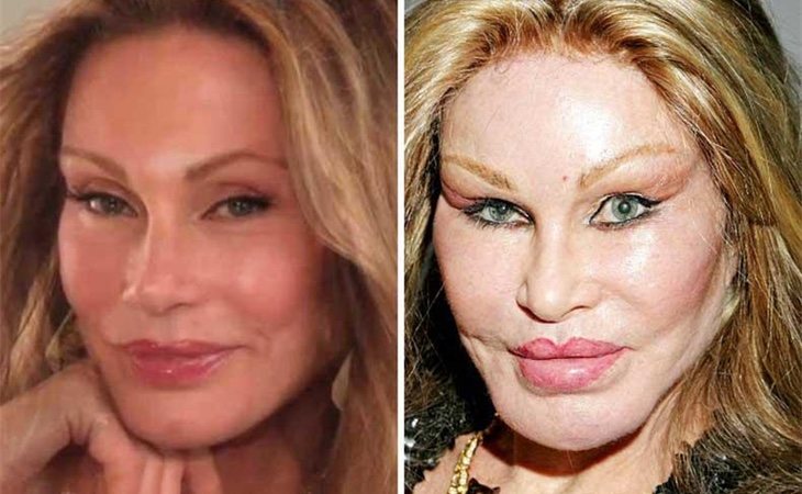 Antes y después de Jocelyn Wildenstein