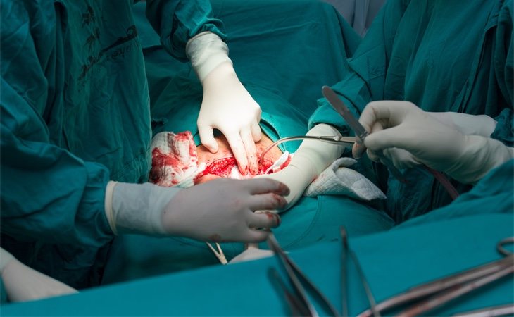 Médicos practicando una cesárea