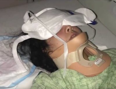 Una joven sufre un derrame cerebral tras intentar el #kikichallenge