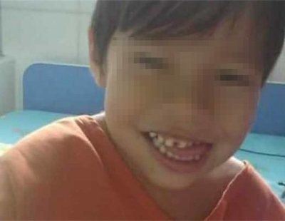 Un niño se queda sin riñones porque su médico se confundió: "Saqué lo que no era"