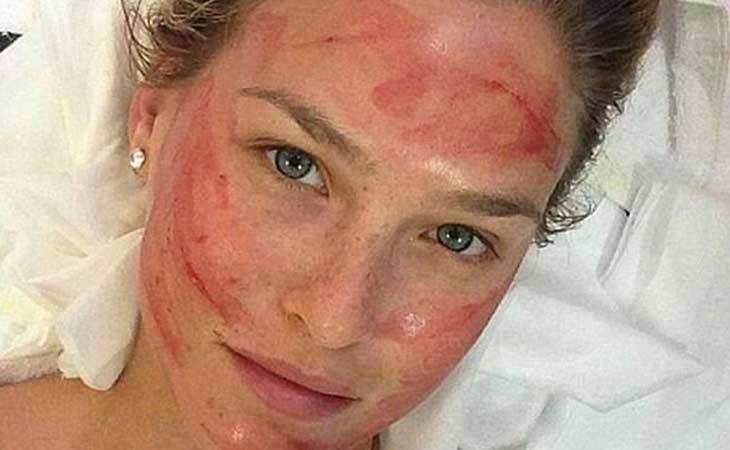 La supermodelo Bar Refaeli tras una sesión de 'vampire facil'