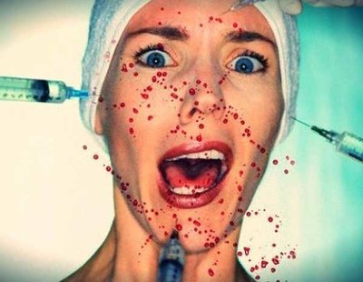 Posibles casos de VIH por el tratamiento 'vampire facial'