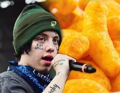 Un rapero ingresa en urgencias tras una sobredosis de Cheetos