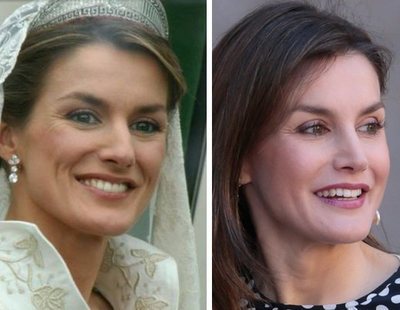 Las operaciones estéticas de la Reina Letizia cuestan 40.000 euros