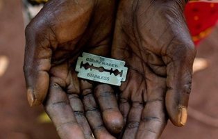 Tolerancia cero con la Mutilación Genital Femenina: causas, consecuencias y soluciones
