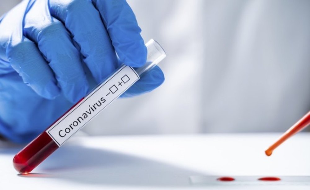 España afronta su primer ensayo de una vacuna contra el coronavirus en fase 3
