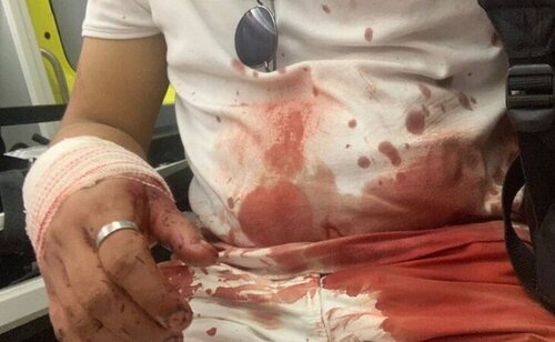 Andrés fue empujado por un barranco en la UAB al grito de "maricón"