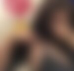 Phoebe muestra uno de sus senos adicionales antes de la cirugía, imagen de sustitución