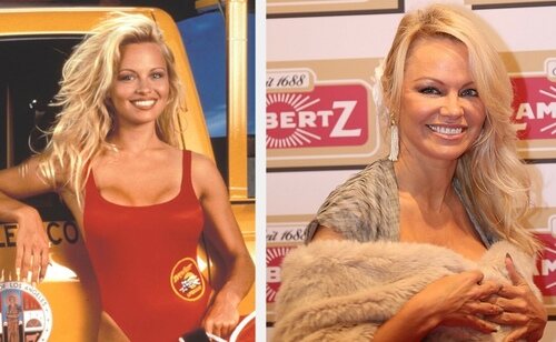 Pamela Anderson antes y después
