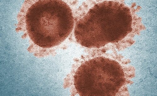 La Comunidad de Madrid ha adoptado nuevas precauciones para evitar la proliferación de la gripe aviar en la región